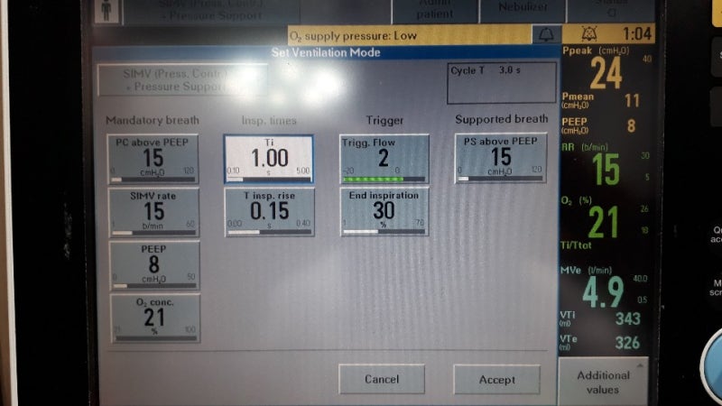 SIMV, Breath cycle time (BCT) updated.. : 네이버 블로그