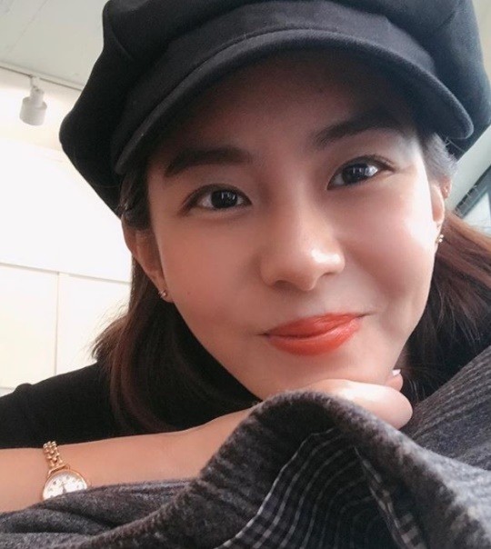  유이 "잘 지내고 있어요..사진이 마르게 나온 것 뿐" 앙상한 사진 해명