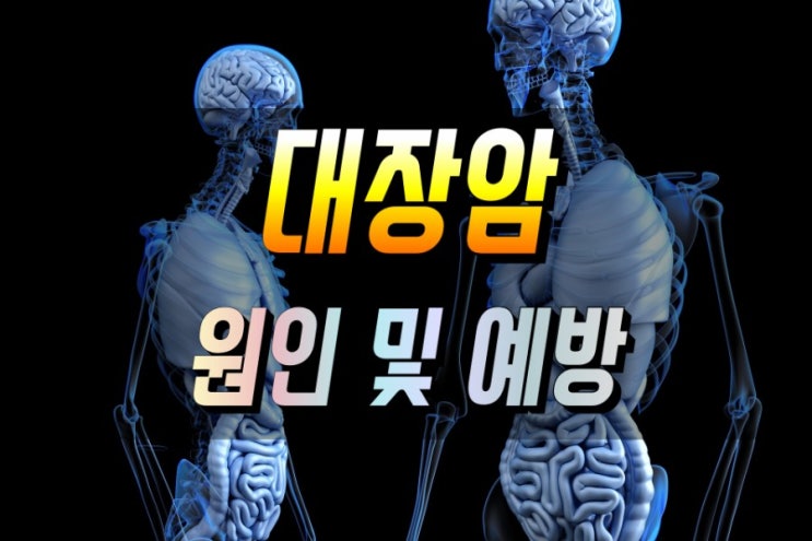  한국인 사망률 1위, 대장암 원인 및 예방법 알아보기
