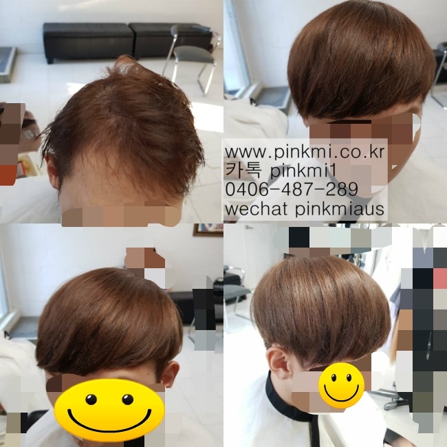  <브리즈번남자m자이마붙임머리증모술PINKMI BEAUTY>브리즈번붙임머리핑크미,브리즈번한인미용실,브리즈번문제성탈모붙임머리,시드니멜번브리즈번붙임머리,Brisbanekorean hair extensions