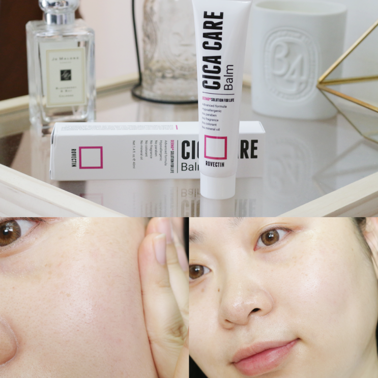  로벡틴 시카케어밤 트러블 지우개 시카크림으로 진정시키기!