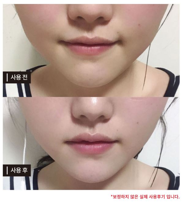  V라인 리프팅밴드 주문폭주 감사합니다! 주문건 내일부터 바로 배송 나가요 :-) 세탁가능, 매일 사용하시면 되요