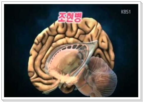  조현병이란, 초기증상, 원인 알아보시죠.