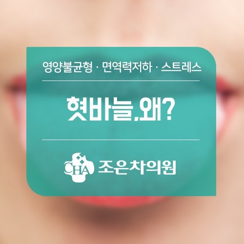 혓바늘돋는이유 어떻게 예방해야 할까요?