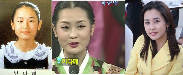 [배우 이다해] 이다해 성형의혹?