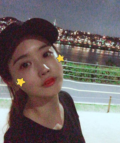 이다해 최근 근황 봤더니..충격 [성형의혹 성형설]