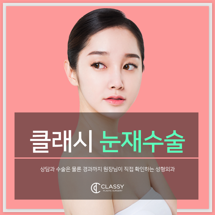  눈재수술병원 계속 빠져드는 눈매