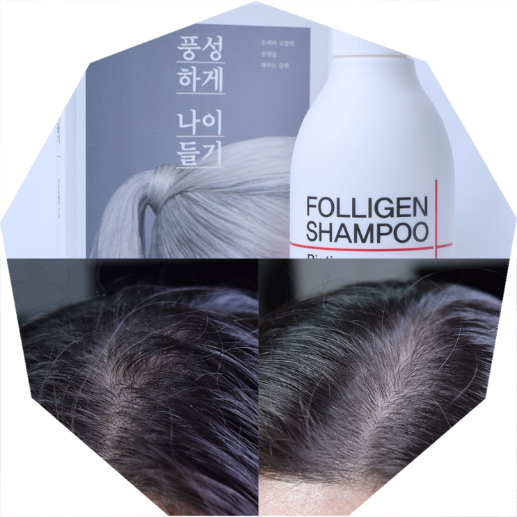  두피샴푸 갑of갑, 닥터포헤어 폴리젠샴푸 후기 공유 dream (탈모예방 하기!)