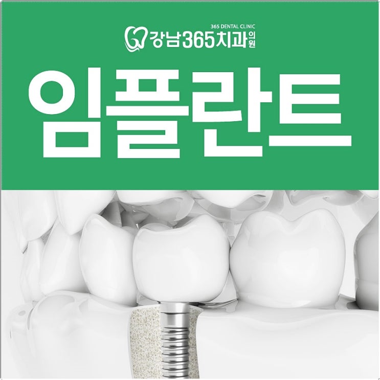  성동구 임플란트 치과 마음에 딱 드는곳