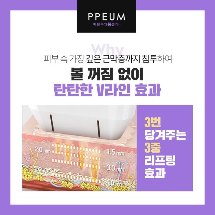  홍대슈링크 하나로 고민 걱정 끝!