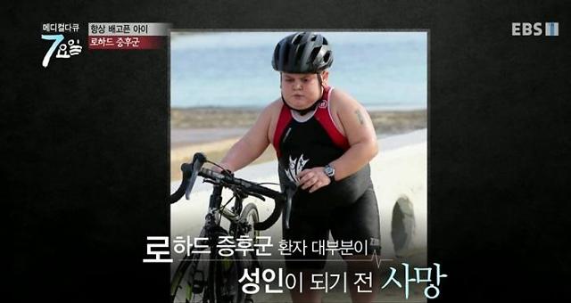  ‘로하드증후군’ 무슨 병?… ‘살빼지 않으면 죽는 병’