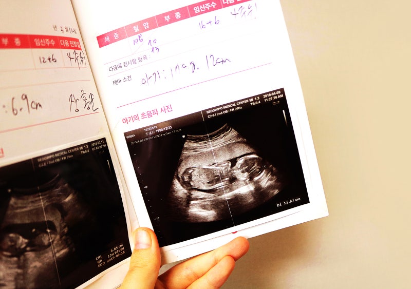 임신 시기 - 6. 증상 및 임신일지/성별 판별 임신 15~17주, 입덧 감소, (안정기)