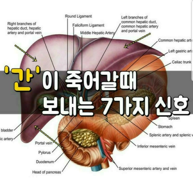  간이 죽어갈때 보내는 신호와 간에 좋은 음식