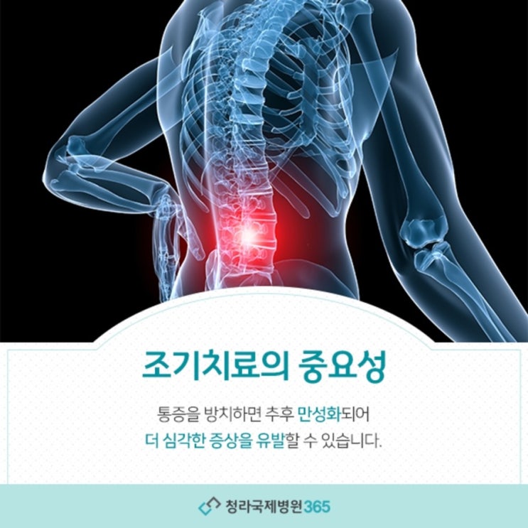  인천정형외과 지속되는 척추통증은?