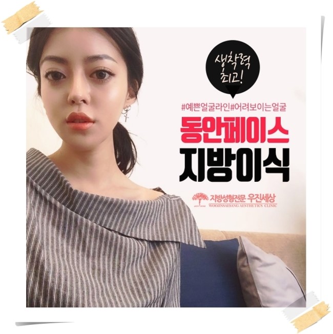  얼굴지방이식가격 적절한 선택으로