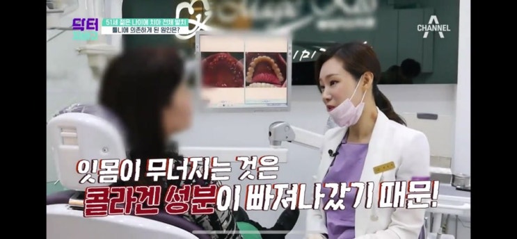  [포커스매거진] 매직키스치과 정유미 원장,채널A <닥터지바고>에서 '콜라겐'과 '치주염'의 상관성 밝혀