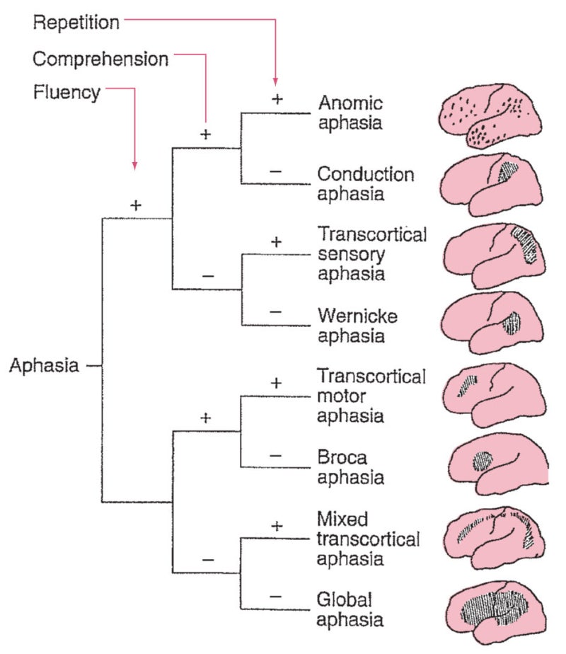 Aphasia _실어증 네이버 블로그