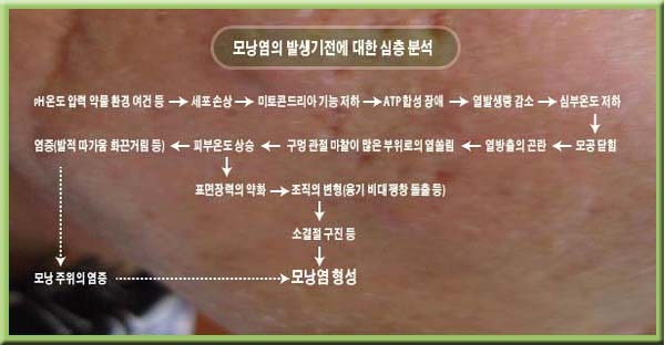 모낭 염증 상태의 치료를 희망하는 경우는, 「이것」을 확인해 주세요. 8
