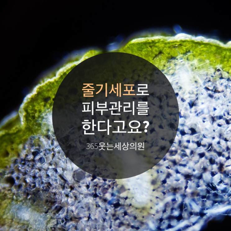  은평뉴타운 피부관리 줄기세포로 젊어지자