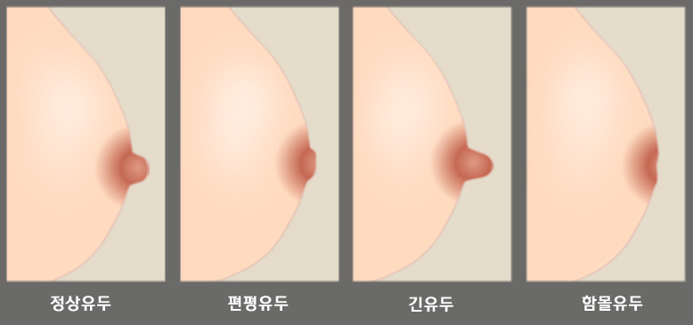 유두의 모양과 임신 중 유방 관리, 식사동산부인과 : 네이버 블로그 유두의 모양과 임신 중 유방 관리, 식사동산부인과 : 네이버 블로그
