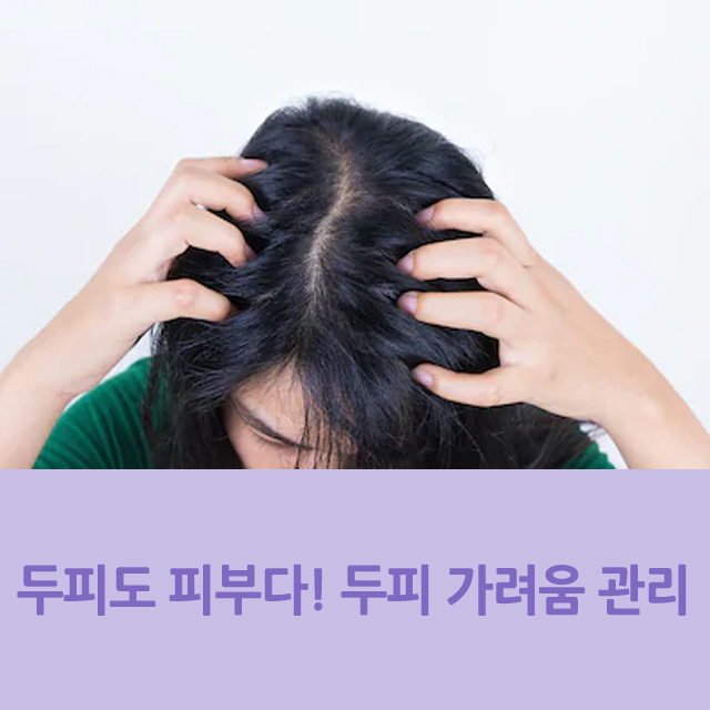  두피도 피부다! 두피 가려움증 원인과 관리법