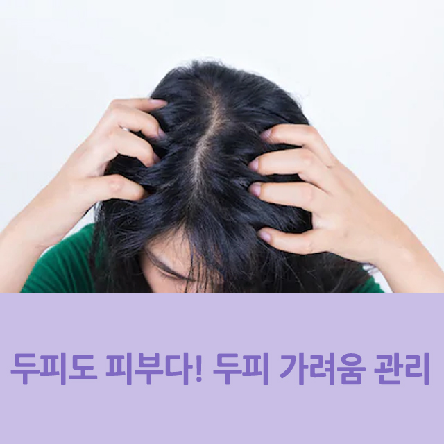 두피도 피부다! 두피 가려움증 원인과 관리법