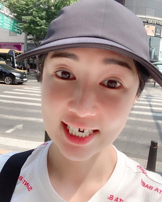 사유리 "앞니 라미네이트가 떨어졌다, 바람이 잘 통해서 좋다" 사유리 "앞니 라미네이트가 떨어졌다, 바람이 잘 통해서 좋다"
