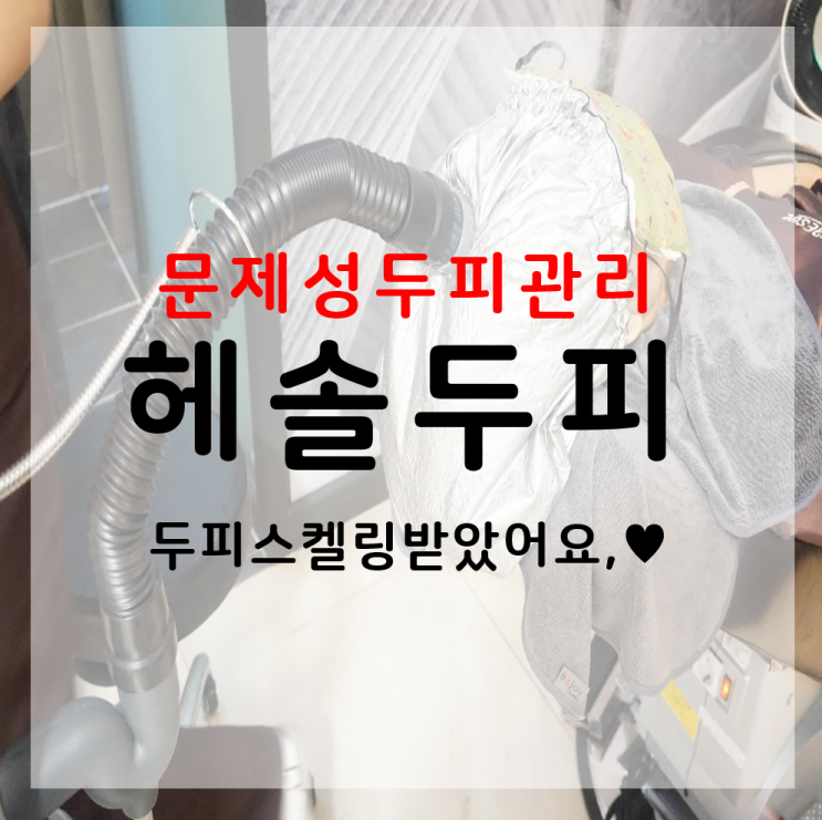  대전두피스케일링 헤솔두피관리센터 롯데대전점 문제성 두피 해결하자