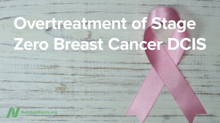 유방암 0기 치료해야 할까? 암 조기진단과 예방적 치료 사이의 딜레마