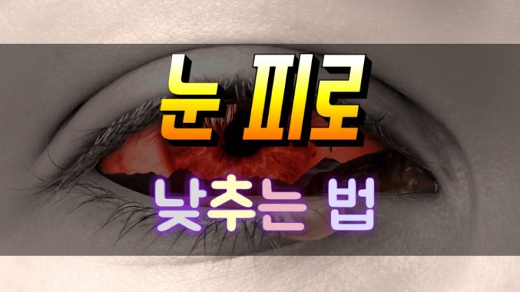  눈을 피로하게 만드는 원인 그리고 예방법 자세히 알아보기