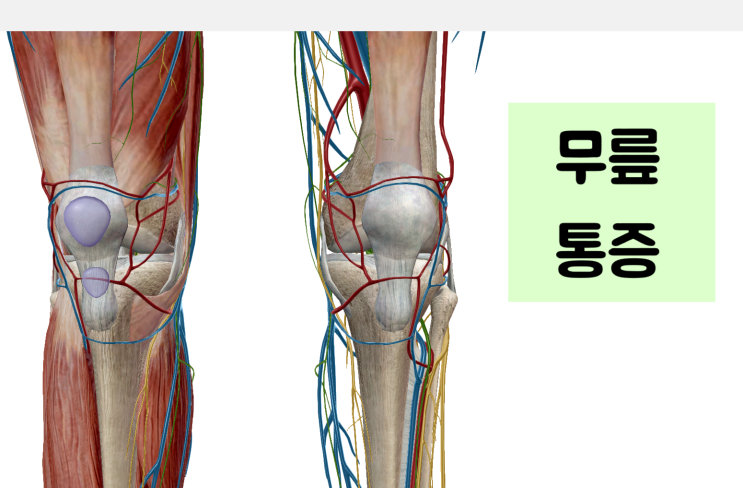 계단 내려갈 때, 올라갈 때 무릎통증[영통/서천동 한의원]