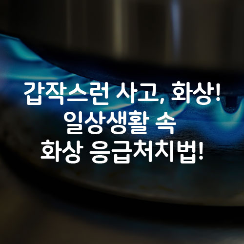  갑작스런 사고, 화상! 일상생활 속 화상응급처치법!