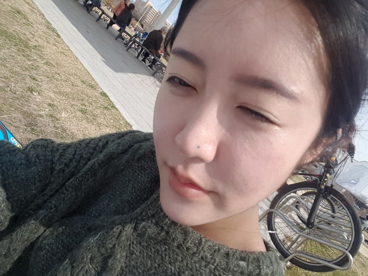  내 돈 내고 받은 FLX 300샷 써마지리프팅후기 1편(유튜브도 있어요!)
