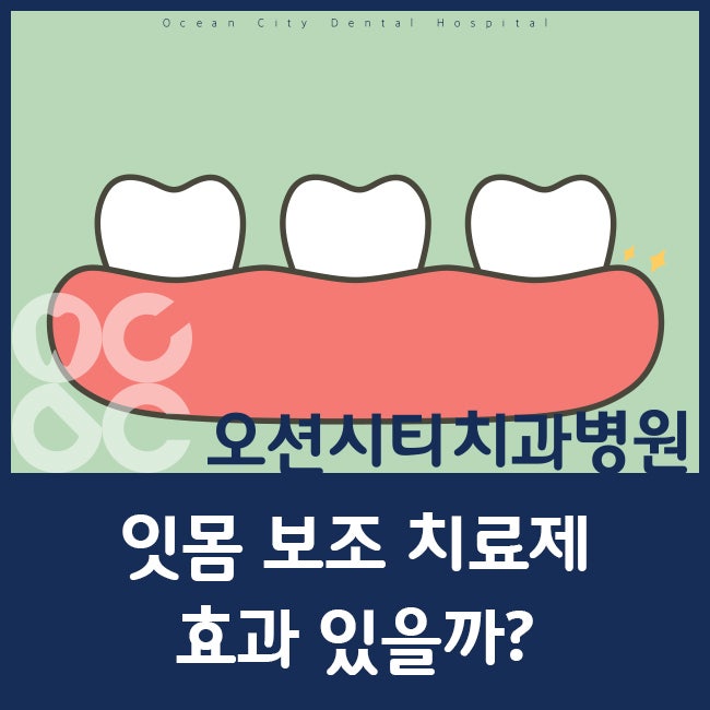 용원 오션시티치과병원에서 잇몸 보조치료제 알려드릴게요!