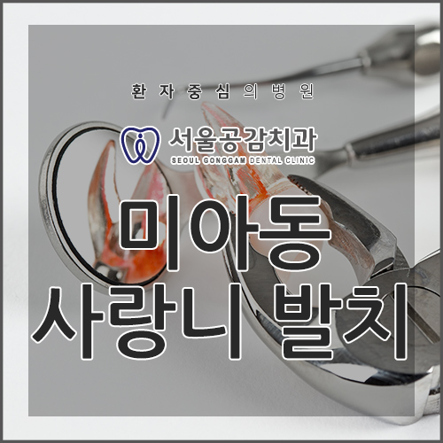  미아동치과, 사랑니 발치 꼭 해야만 할까?
