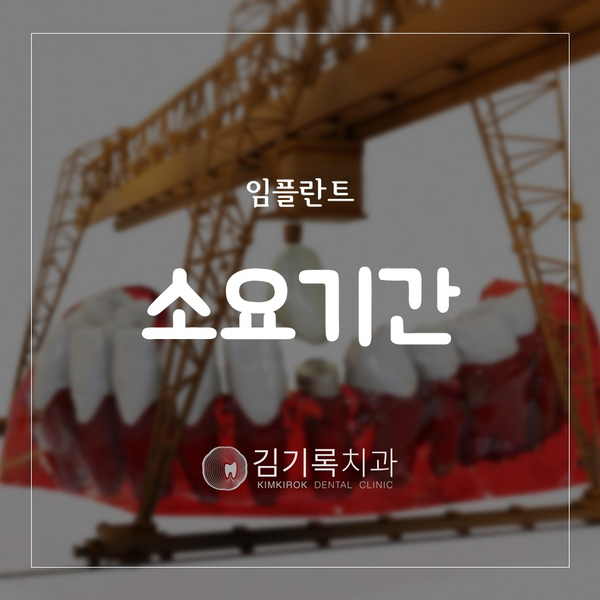 수원임플란트안아프게잘하는곳 임플란트를 하는 데 얼마나 걸려요? 임플란트 시술 기간 소요 기간