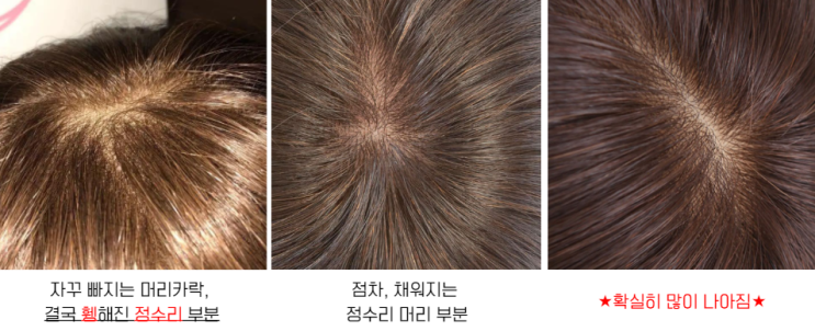  헤드스파7 후기 트리트먼트 탈모 쿠라코마에 샴푸(대박)