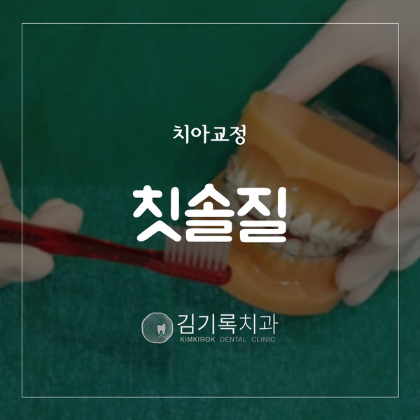 수원치아교정잘하는곳 치아교정 중 칫솔질 양치질은 이렇게! 치간칫솔 치실 혀닦이 구강용품 사용 방법
