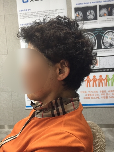  안동보청기: 보청기 착용 시기 빠를수록 좋아요