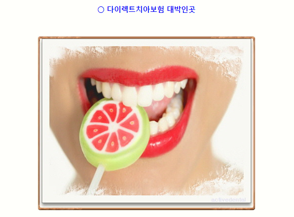  다이렉트치아보험추천 보장정리
