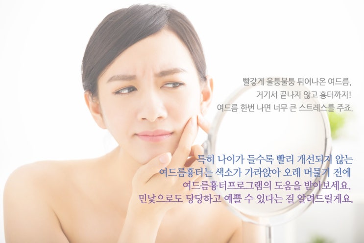  청주여드름흉터 제거시술받았어요