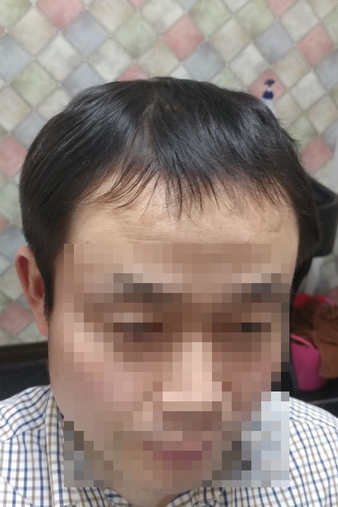  생생정보마당가발 곽민재원장님 최고