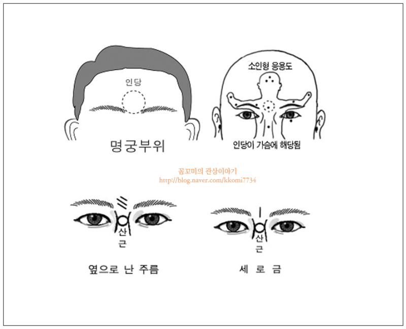 리틴플가산미간주름관상에도중요합니다