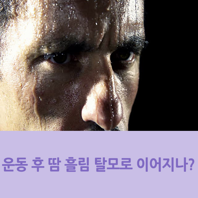  운동 후 과도한 땀 흘림, 탈모로 이어지나?