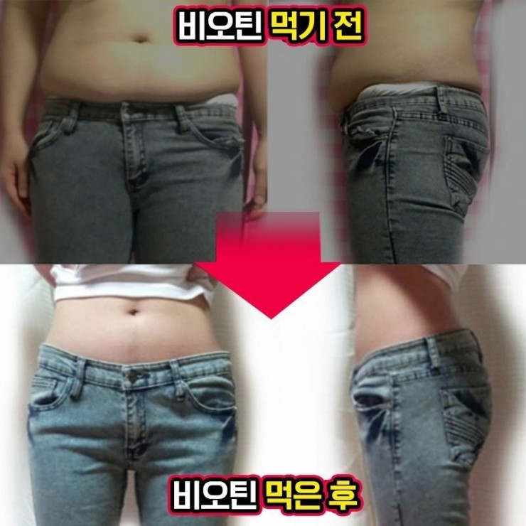  내성인저격 지금껏 가장 쎈 조합, 카테킨 최강! 가르시니아 최강! "탑바디V1 + 2455" 