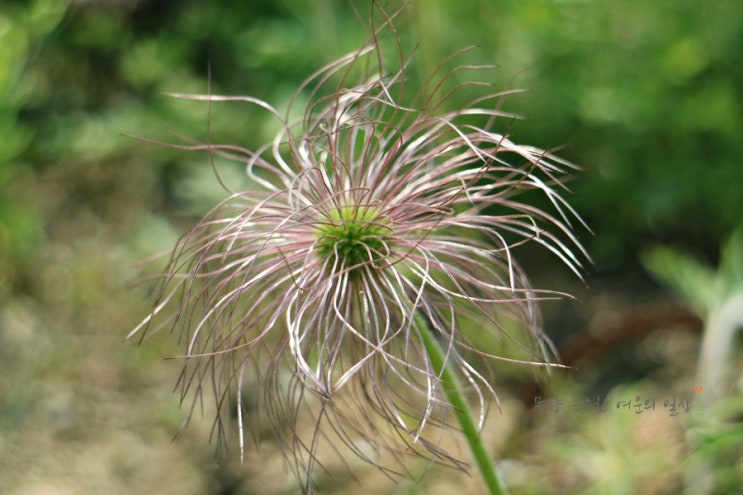  신비한tv서프라이즈 희귀질병 역경사형난청을 아시나요?