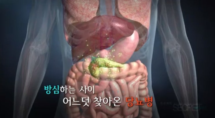  당뇨 증상 및 혈당관리방법<달맞이꽃종자추출물>