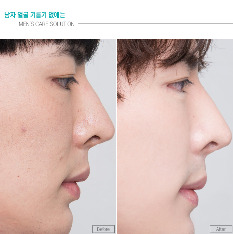 라 로제젤 크림 안지가 많은 복합성 피부에 수분젤같아