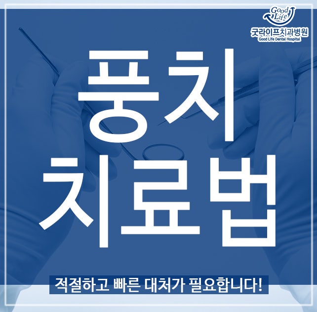 풍치치료법, 적절하고 빠른 대처가 필요합니다!
