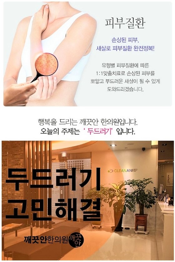  대구두드러기 증상으로 고민이라면, 두드러기치료 한의원을 찾으세요!